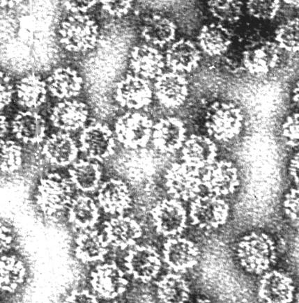 Rekombinantinių vakcinų sudėtyje yra virusų baltymų, kurie formuoja į virusus panašias struktūras. Tai tušti virusų apvalkalai, kurie imituoja tikruosius virusus ir išmoko imuninę sistemą juos atpažinti. Tokios į virusus panašios dalelės yra labai mažos (apie 0,05 mikronų dydžio), todėl nematomos paprastu mikroskopu. Šios nuotraukos gautos elektroniniu mikroskopu, didinančiu vaizdą 100 000 kartų